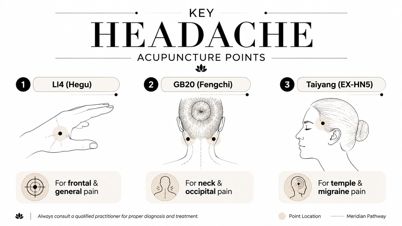 An educational infographic illustrating three key acupuncture points for relieving different types of headache pain.
