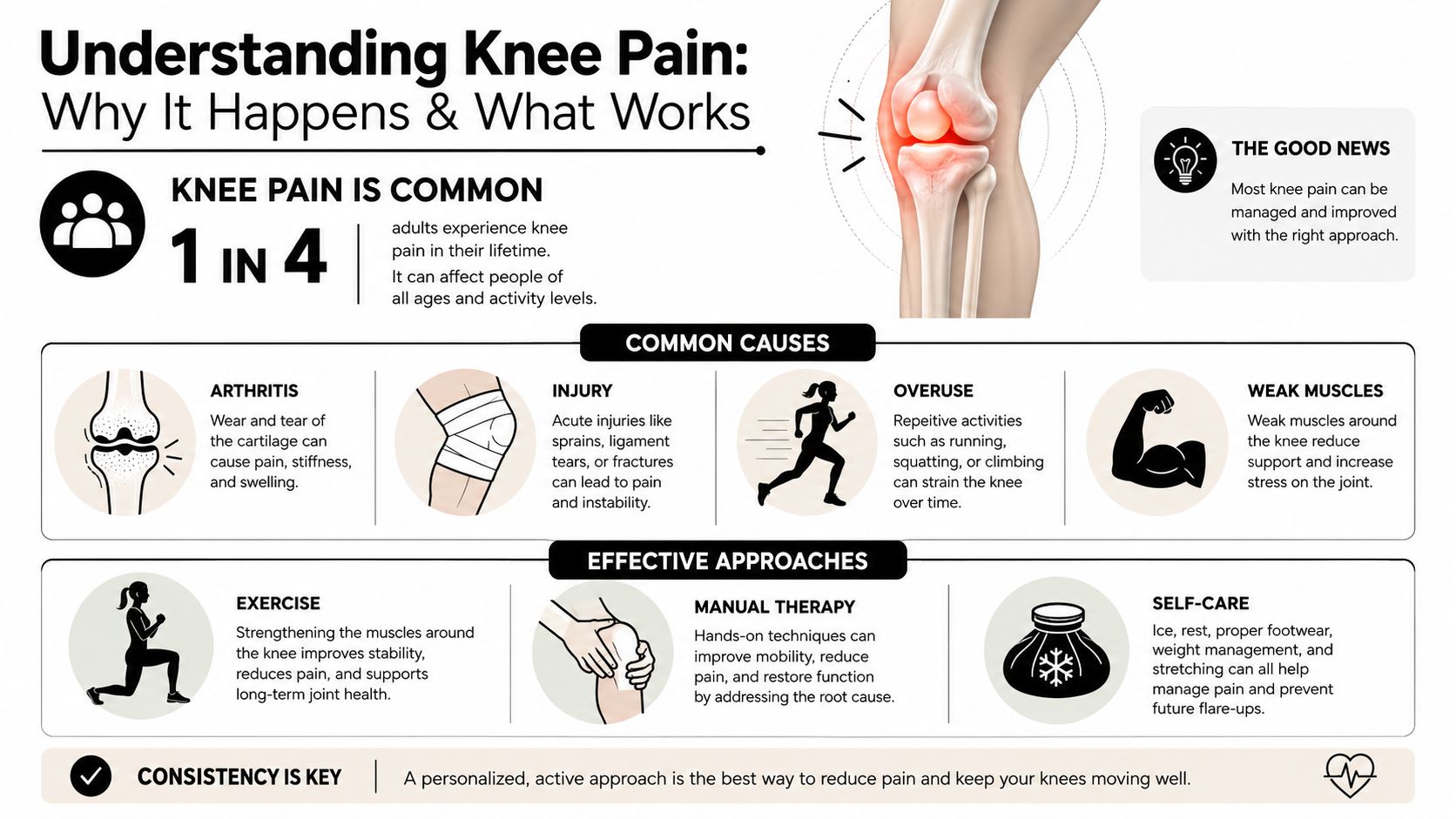 An infographic detailing common causes of knee pain and effective non-surgical approaches for management and recovery.