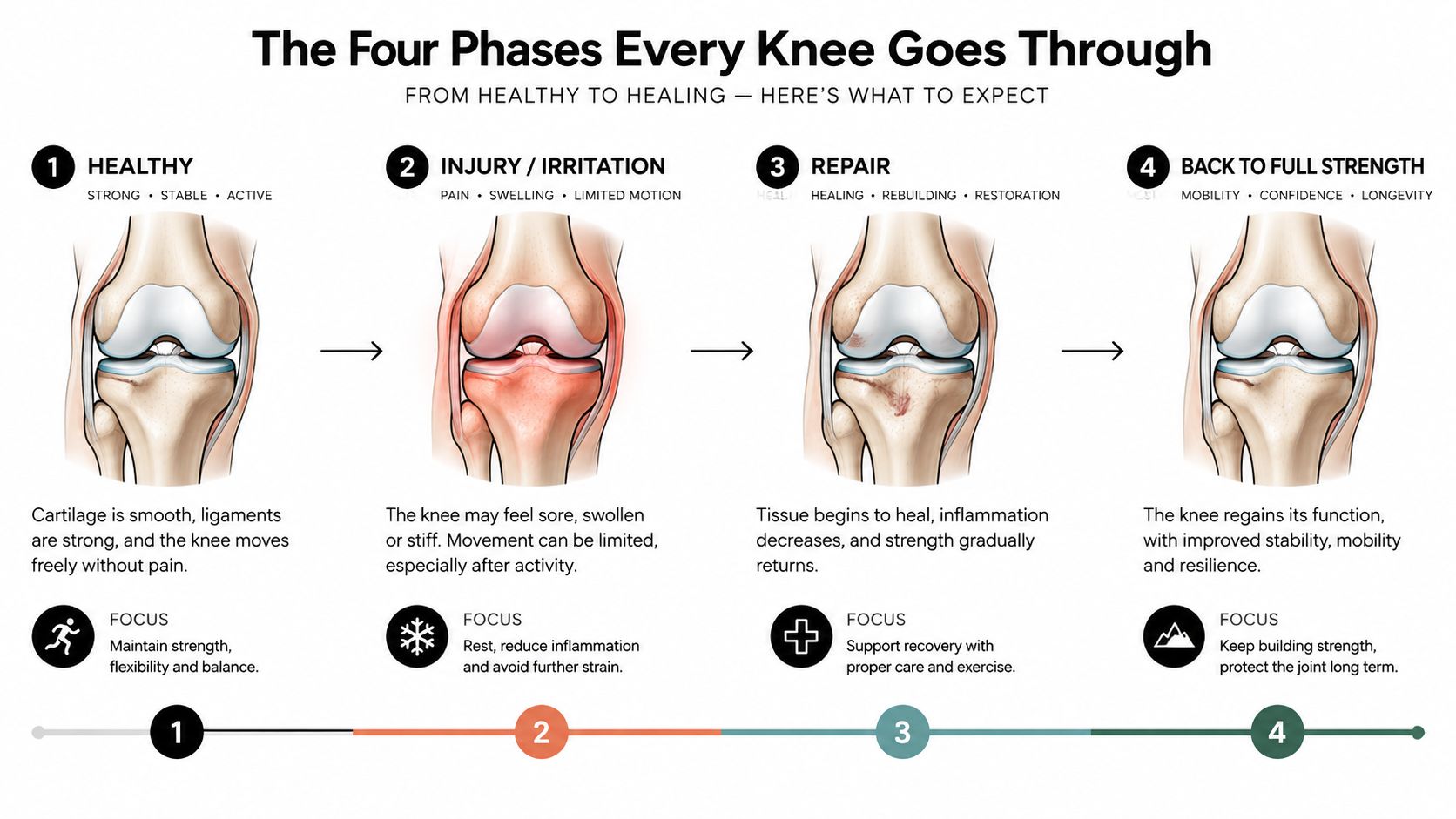 An infographic detailing the four phases of knee recovery, from healthy state to full strength and rehabilitation.