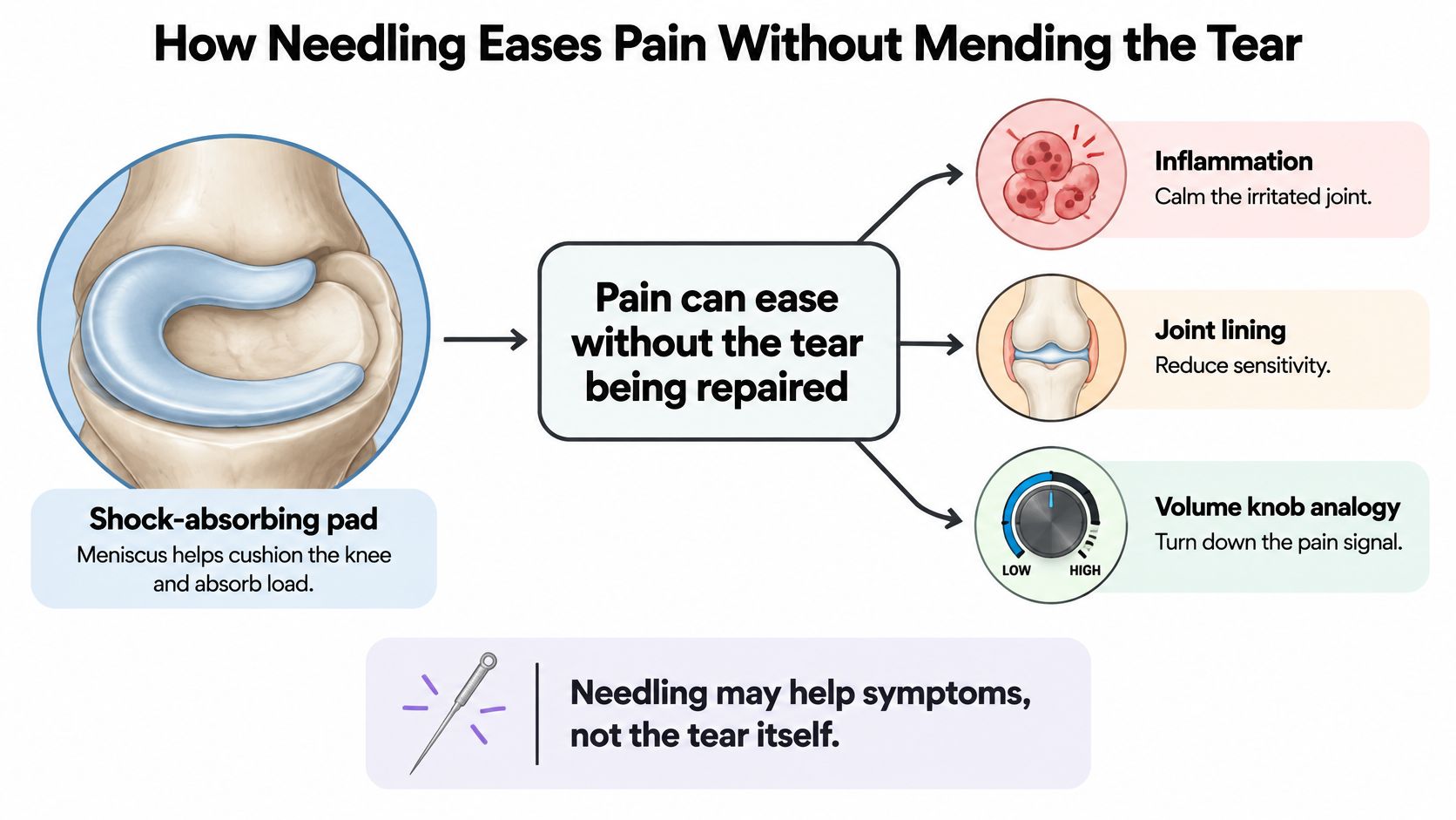 An infographic illustrating how needling techniques can alleviate knee pain symptoms despite meniscus tears remaining unrepaired.